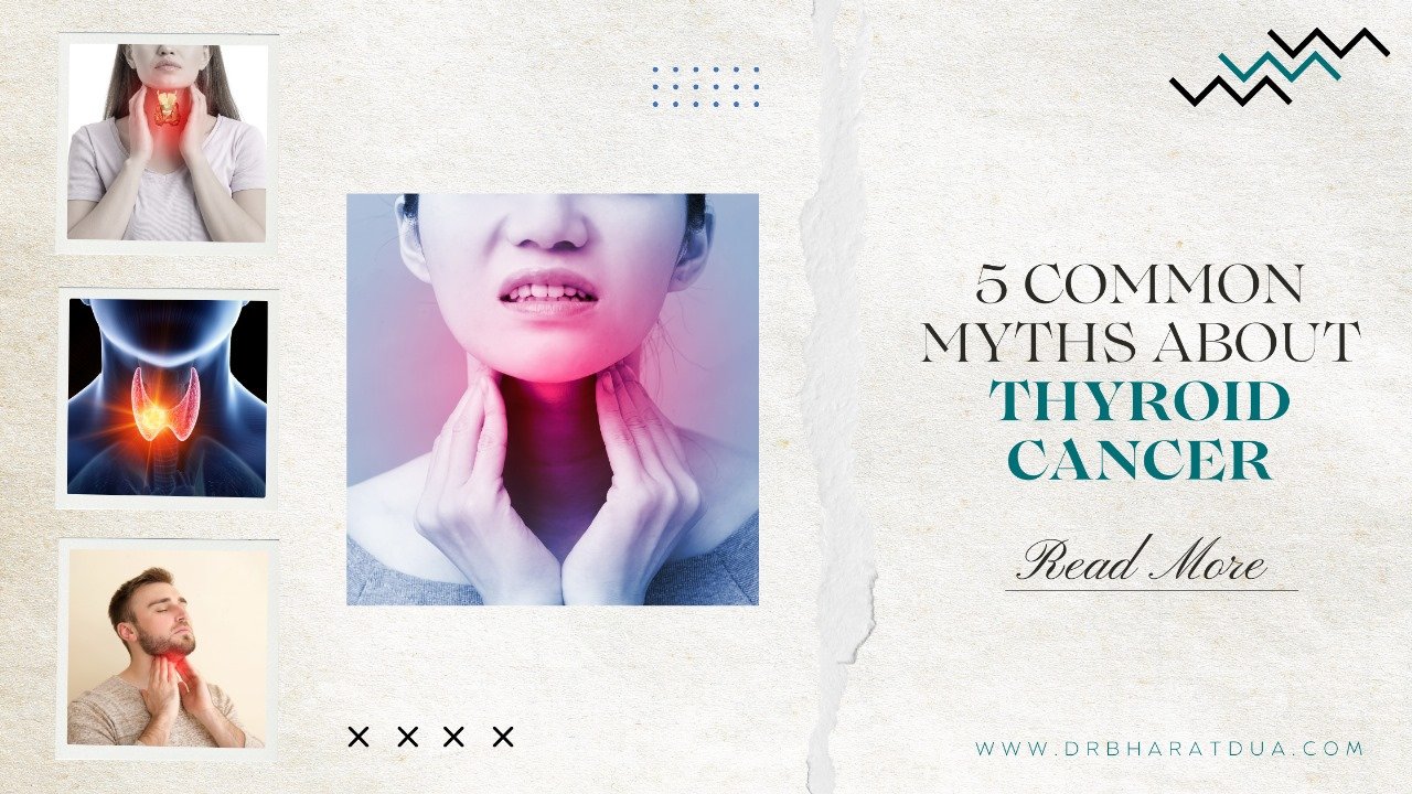 5 Common Myths About Thyroid Cancer — Busted by Experts
